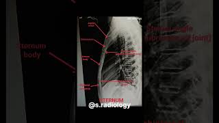 Anatomy of sternum x ray anatomy shortvideo [upl. by Nnaeerb]