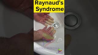 Raynauds Syndrome [upl. by Ner64]