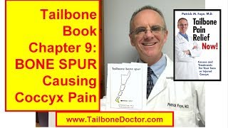 Chapter 9 Tailbone Bone Spur Causing Coccyx Pain [upl. by Anai722]