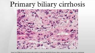 Primary biliary cirrhosis [upl. by Harbard]