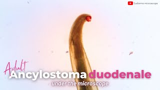 Adult Ancylostoma duodenale under the microscope [upl. by Inaj]