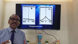 Chronic eustachian tube dysfunction Hindi Patient teaching programme [upl. by Rossy]