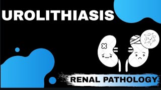 UROLITHIASIS  Renal pathology  Med Bees [upl. by Humberto]