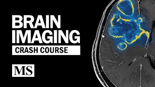 Brain Imaging Crash Course [upl. by Norrehc]