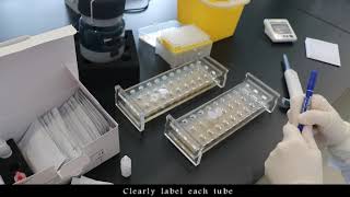 Cryptococcal rapid test Lateral Flow Assay  Era Biology [upl. by Nnayelhsa]