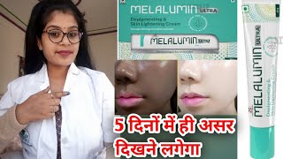 Melalumin Ultra Depigmenting Cream Uses amp Side effects in hindi  Melalumin Ultra skin cream uses [upl. by Ellac]