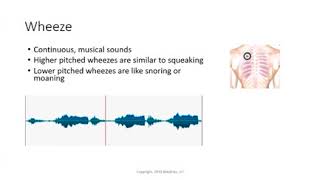 Wheeze Lung Sounds [upl. by Tyika]