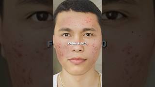 Zuniga on Natural Face Mask Glow Up in 7 Days [upl. by Daisey709]