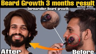 Dermaroller for beard growth  Derma roller beard before and after  Beard Products  review [upl. by Enej810]