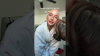 me I’m bald 😃 funny bald alopecia wigs comedy [upl. by Farley]