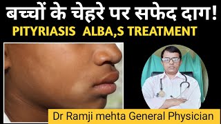 White Patch on Face  Is This Vitiligo or Pityriasis Alba बच्चों के चेहरे पर सफेद दागDr Ramji [upl. by Gladis]