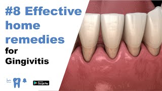 8 Effective home remedies for gingivitis [upl. by Cathrine65]