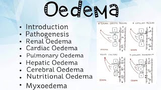 Oedema Pathology [upl. by Aneehsak918]