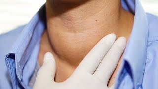 Tratamiento utiliza aguja con calor para extirpar bultos o nódulos en el cuello [upl. by Mittel]