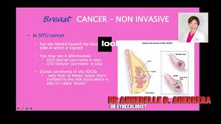 DUCTAL CARCINOMA IN SITU [upl. by Snave]