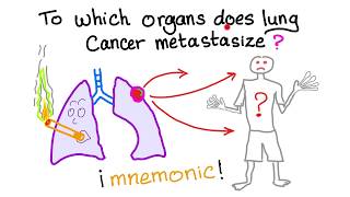 Mnemonic Which organs does lung cancer metastasize to [upl. by Ailemrac]