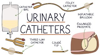 Urinary Catheters [upl. by Bezanson]