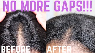 HOW TO FIX CROCHET BRAID SPACINGGAPS Invisible Part  crochetbraids [upl. by Torhert522]