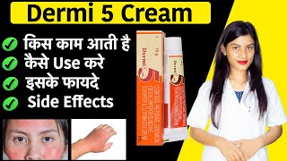 Dermi 5 Cream Uses for Face  Dermi 5 Cream Uses in Hindi  Clobetasol Propionate Gentamicin Cream [upl. by Donalt]