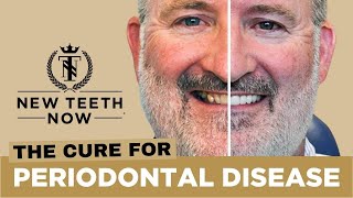 Cure for Periodontal Disease [upl. by Cosma102]