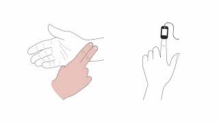 Mastering transcutaneous pacing [upl. by Hardigg]