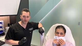 Female Facial Sculpting with Belotero  Smokers Lines and Lip Rejuvenation  West Hollywood CA [upl. by Yekim]