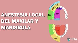 Técnicas de Anestesia Maxilar  SupraperiostealSubperiosteal Malamed Odontologia [upl. by Yecats]