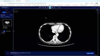 Feature preview Documents as links and attaching high resolution DICOM imagery [upl. by Refannej]