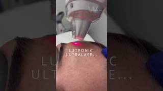 Pair our Lutronic Ultra Laser with the Aquagold for the ultimate silky smooth glass skin [upl. by Arabeila162]