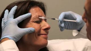 Crows Feet botulinum toxin injection training [upl. by Aninaig]