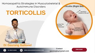 Homoeopathic Strategies in Torticollis Dr Gaurang Gaikwad [upl. by Aniretake]