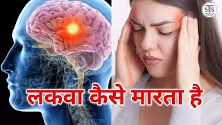 lakva kaise marta hai लकवा कैसे मारता है paralysis medical 3danimation study lakva explore [upl. by Arlena]