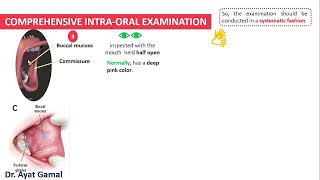 Intraoral exam part 2 Buccal mucosa [upl. by Hafirahs]