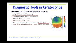 Diagnostic Tools in Keratoconus by DrMoataz Wessam [upl. by Adlesirhc]