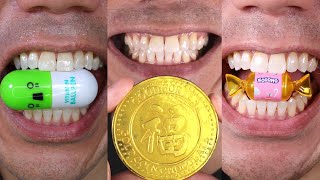 Experience Pure Satisfaction with Doctor Tristan Pehs Chewing ASMR [upl. by Winona]