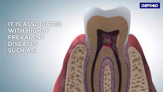 What is oral biofilm [upl. by Bonn]