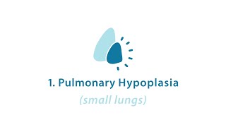 CDH Part 2 CDH Pulmonary Hypoplasia [upl. by Ennairoc]