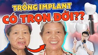 Trồng Răng Implant Có Vĩnh Viễn Không Nguy Cơ Hỏng Cao Nếu Không Đáp Ứng 3 Tiêu Chí Này [upl. by Ettinger]