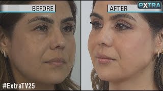 How to Get a Quick FaceLift Without Surgery [upl. by Jeroma772]