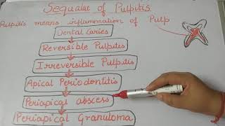 Pulpitissequalaeofpulpitislecture1dentalnotes [upl. by Lefty]