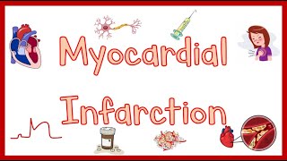 Myocardial InfarctionHeart Attack Causes Pathogenesis Signs amp Symptoms Diagnosis amp Treatment [upl. by Gerkman415]