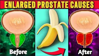 Warning These 5 Foods Causes Enlarged Prostate  Shrink Enlarged Prostate [upl. by Whitby]