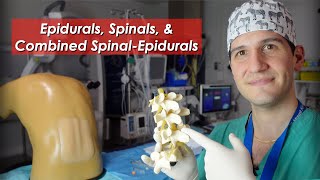 Epidural spinal and combined spinalepidural overview [upl. by Cris]