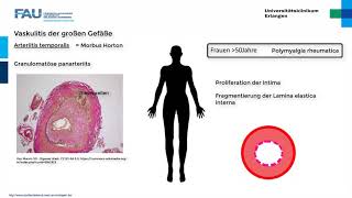 Rheumatologie ─ Vaskulitiden Teil 13 [upl. by Akirat]