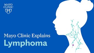 Mayo Clinic Explains Lymphoma [upl. by Haelahk]