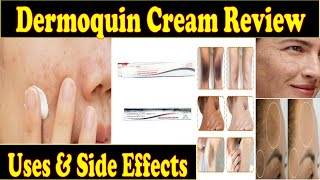 Dermoquin Cream ReviewDermoquin uses amp Side Effects in UrduAyeshaa Naeem ❤️ [upl. by Hnahym508]