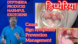 DIPTHERIA डिप्थेरिया बैक्टीरिया में जानलेवा EXOTOXINS infectiousdisease [upl. by Eirallam826]