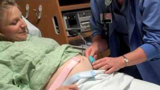 Maternity Fetal Monitoring [upl. by Treve]