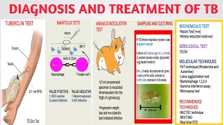 Diagnosis and treatment of Mycobacterium TB  Tuberculin mantoux test  Medical micro Part3 [upl. by Notecnirp]