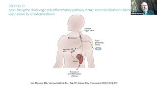 UW Rheumatology Grand Rounds  Andrew Holman 11122024 [upl. by Ros443]